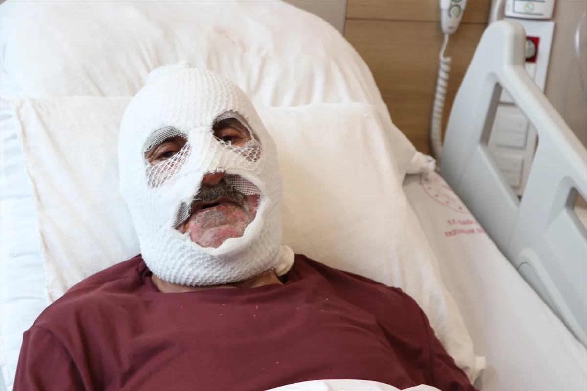 Tüpteki gaz kaçağını çakmakla kontrol edince hastanelik oldu